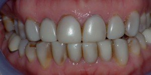 dentist raleigh nc