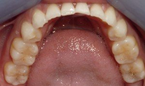 dentist raleigh nc