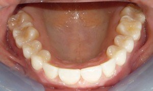 dentist raleigh nc