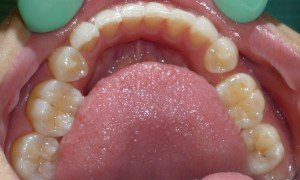 raleign dentist