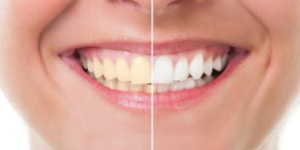 image_2024-12-05_135749155